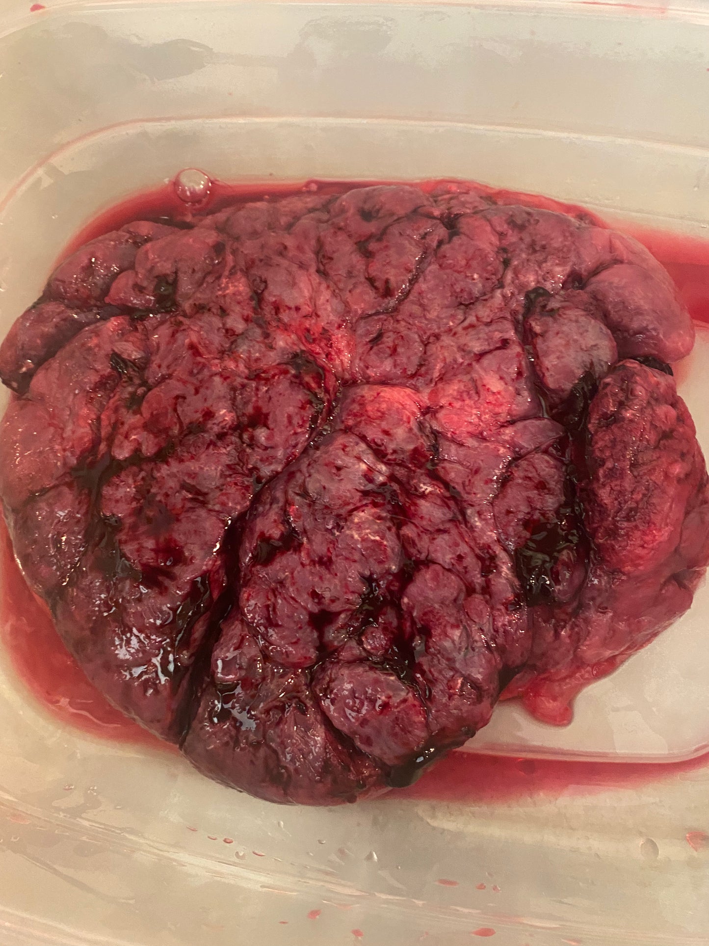 Placenta encapsulation