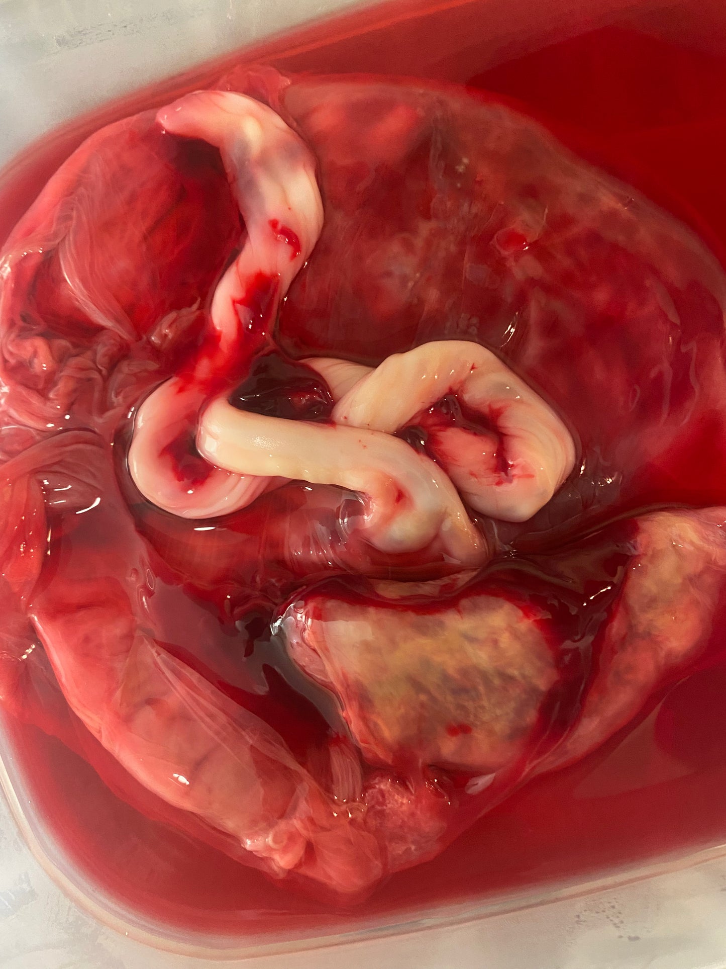 Placenta encapsulation