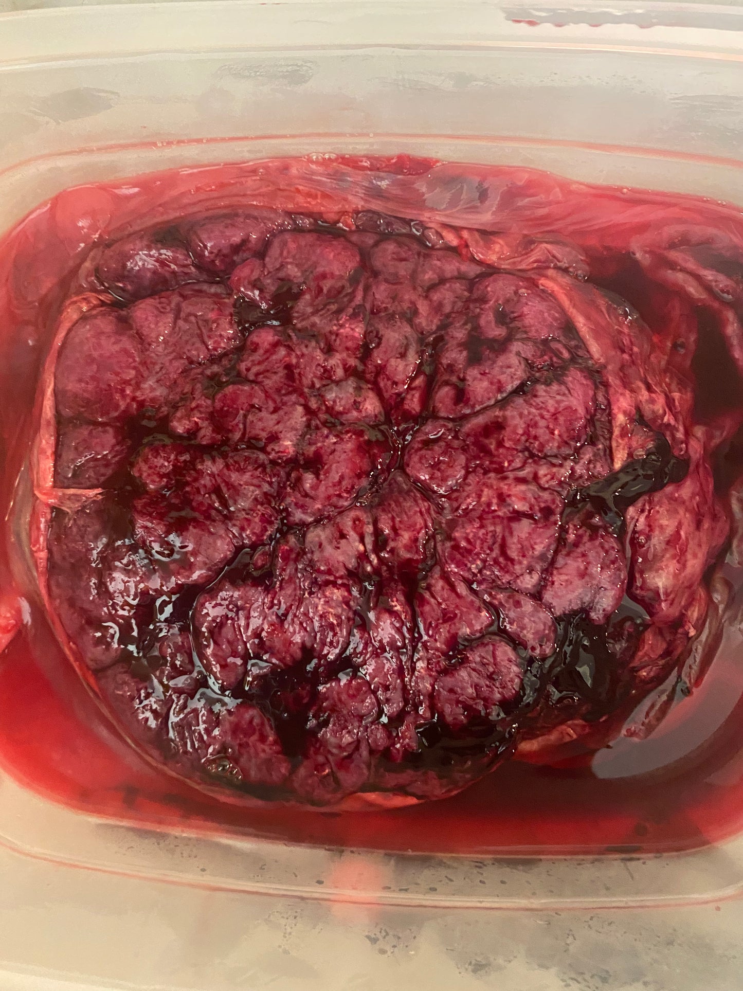Placenta encapsulation